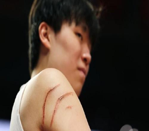太拼了!杨瀚森与火箭内线肉搏缠斗,右臂出现两道大血印