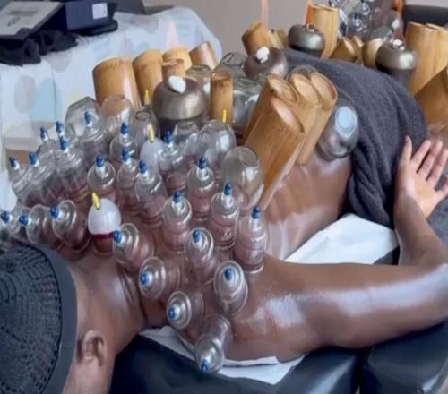 挺管用，吉拉西接受拔罐治疗后在对阵美因茨时梅开二度