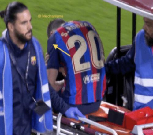 巴萨队副重伤无缘世界杯慎点脱臼后骨头支棱出来