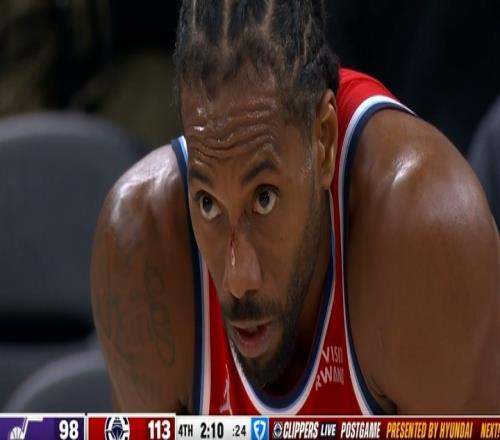 小卡末节20分细节：上篮时脸被抠出血爵士竟挑战成功激出战神卡