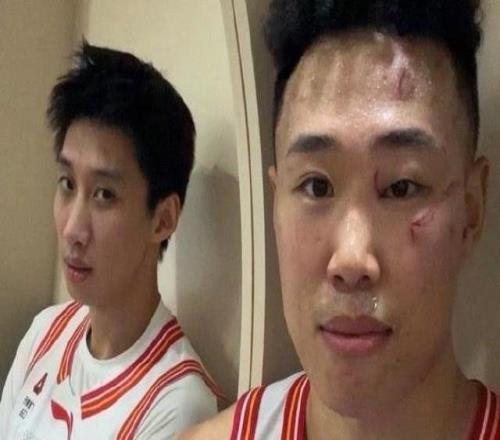 广东vs深圳前瞻：周鹏率队反戈旧主徐杰胡明轩主场欲避连败